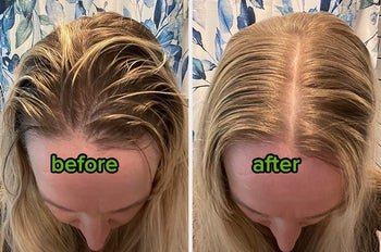 Reviewer before using the dry shampoo powder, with extremely oily blonde hair, and after using it with hair looking much fresher and less greasy