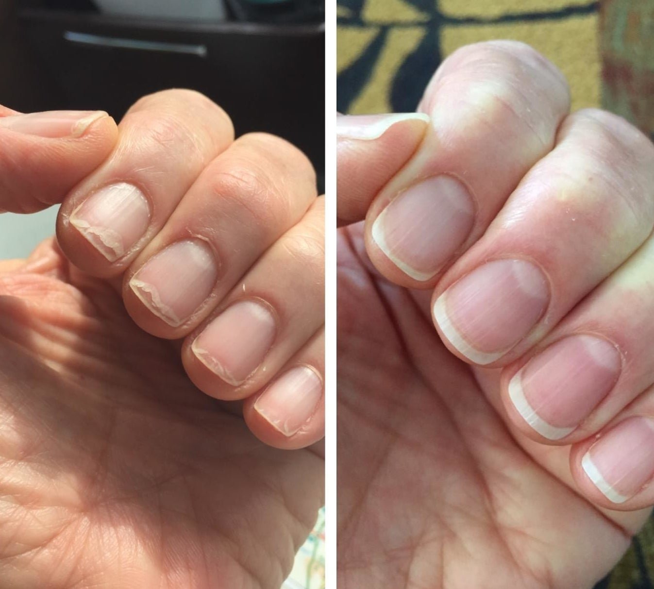 A before-and-after of a reviewer's peeling, split nails compared to their now even and non-peeling nails 